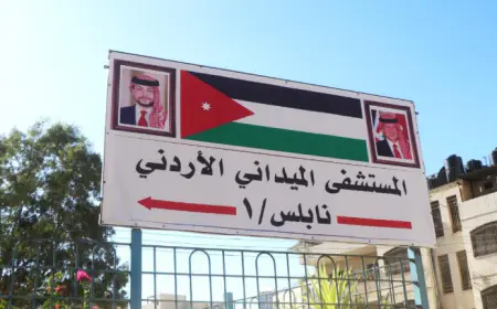 "ميداني" نابلس يُجري عملية فصل التصاق الأصابع لطفلة