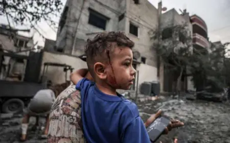 70 بالمئة من  ضحايا العدوان الإسرائيلي  "أطفال ونساء"