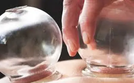 الحجامة.. والطب البديل