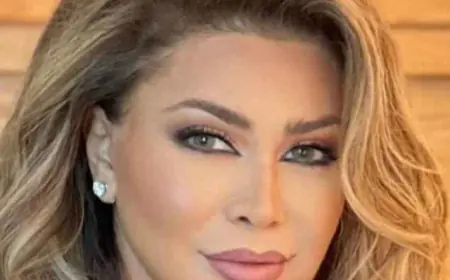 فيديو.. (الفلر) يتسبب بتشوه للفنانة نوال الزغبي