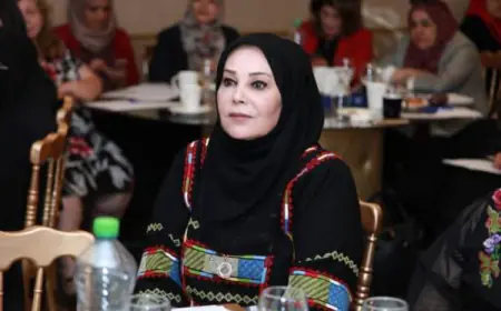 الدكتورة ميسون تليلان.. تجري عملية جراحية ناجحة