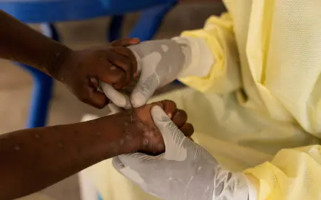 الأردن..  إجراءات على جميع المراكز الحدودية والمطارات لرصد جدري القردة