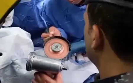 بالصور.. الدفاع المدني يحرر يد طفلة علقت في ماكينة فرم لحوم