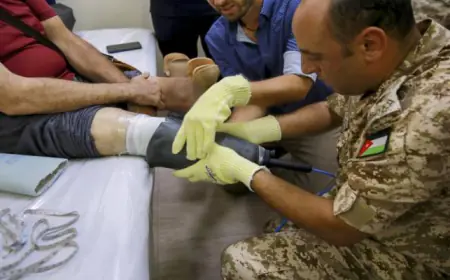 بدء تركيب الأطراف الاصطناعية للمصابين جنوب غزة