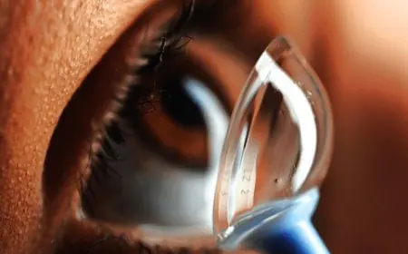 ابتكار سويسري عالمي لملايين البشر.. علاج تلف القرنية بالطباعة ثلاثية الأبعاد