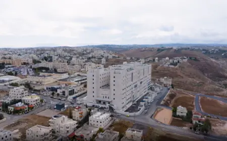 مستشفى الأميرة بسمة الجديد يتسلم أول جهاز رنين مغناطيسي بتقنية الذكاء الاصطناعي