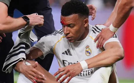 قصة إصابة مبابي (الدامية) أمام جيرونا.. ومدرب ريال مدريد يخرج عن صمته