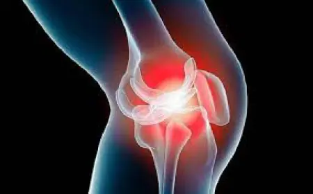 اكتشاف علمي قد يُحدث ثورة في علاج التهاب المفاصل