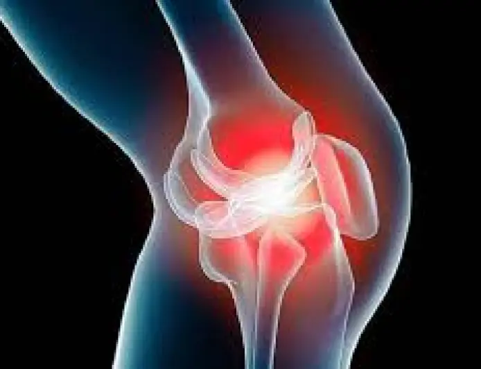 اكتشاف علمي قد يُحدث ثورة في علاج التهاب المفاصل