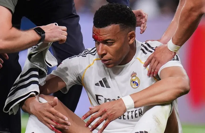 قصة إصابة مبابي (الدامية) أمام جيرونا.. ومدرب ريال مدريد يخرج عن صمته